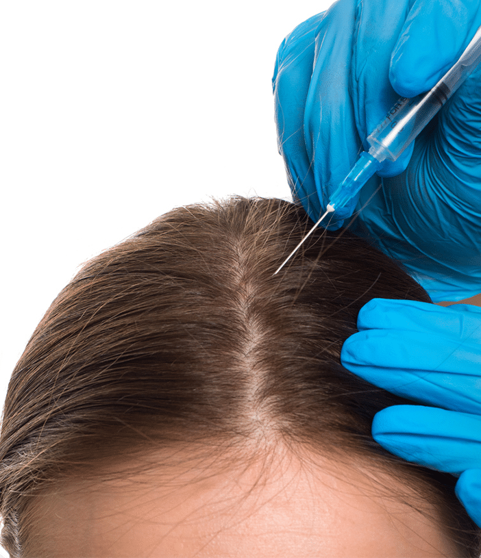 hair surgeon injecting a patient's scalp