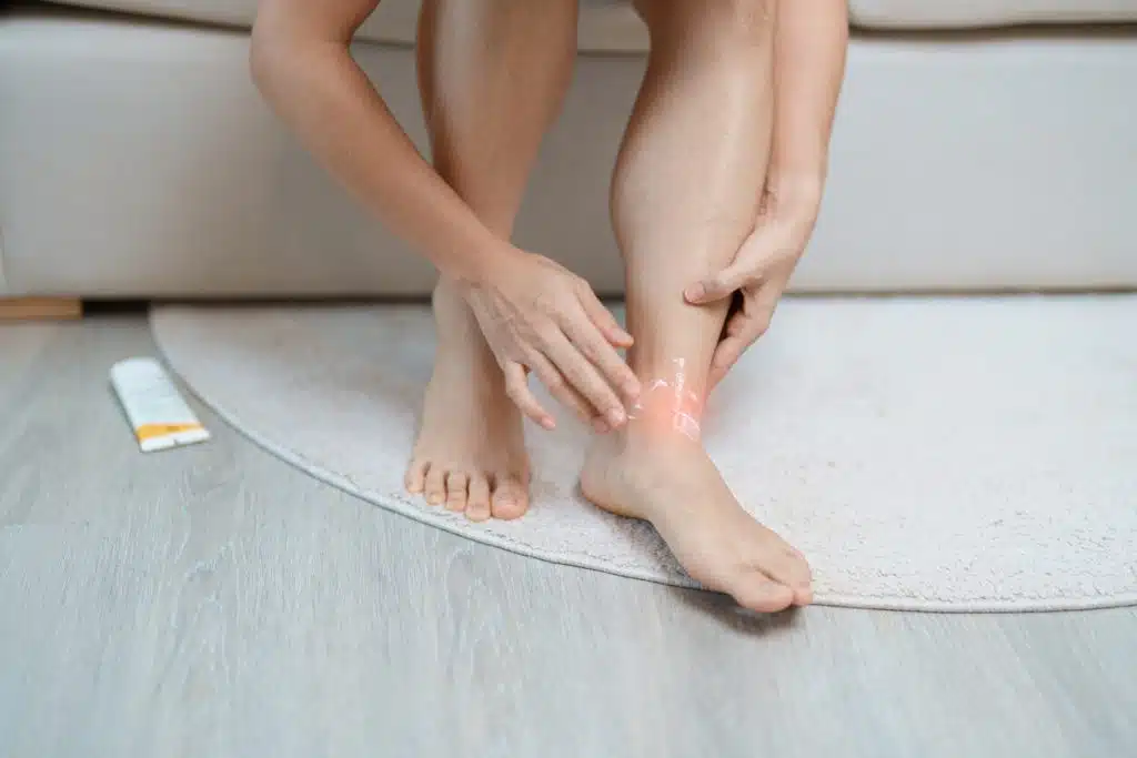 A woman sitting on the couch at home has leg pain due to ankle sprains, Achilles tendonitis, or shin splints.