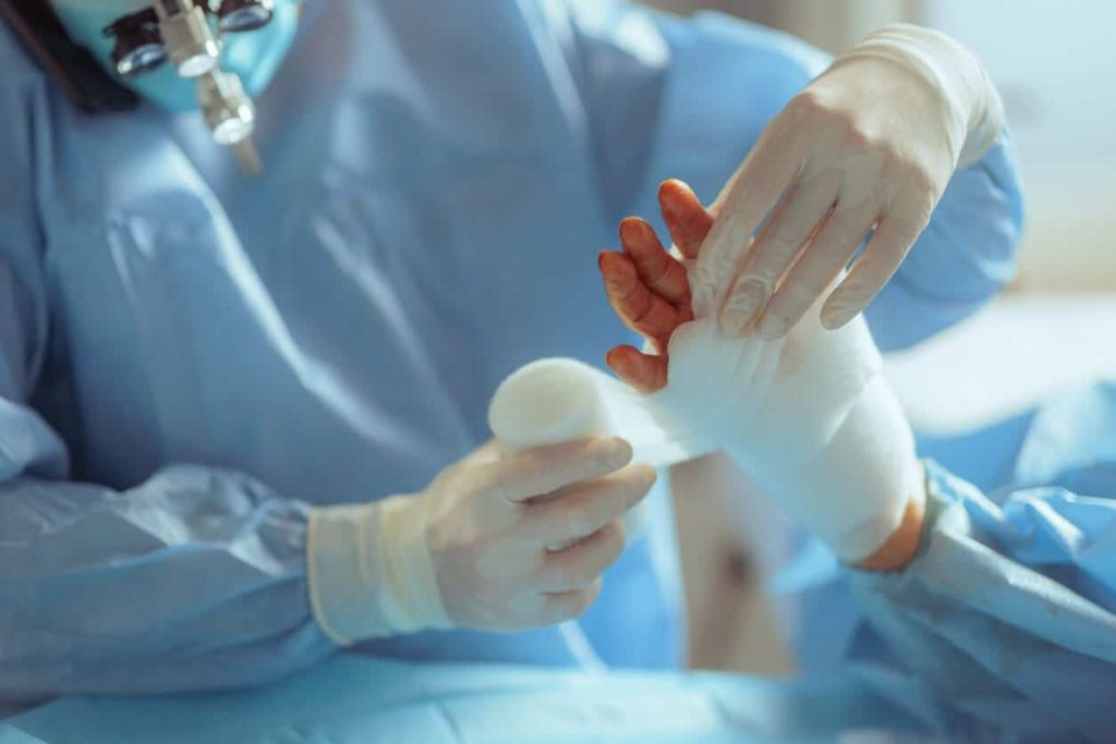 Hand Help Process What Is the Recovery Process After Hand Surgery? - Greater Chesapeake ...