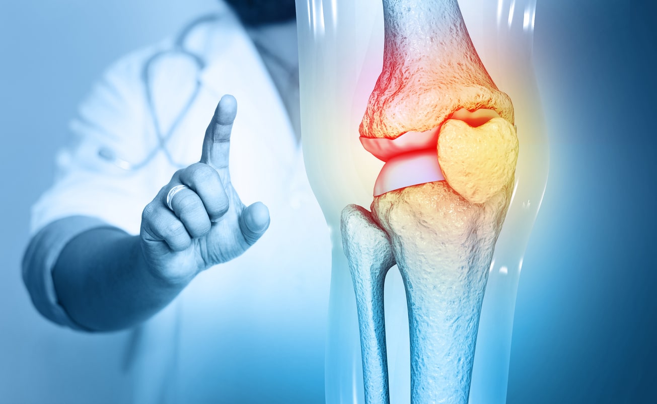 3 Common Joint Problems to Watch Out for - Greater Chesapeake Hand to ...
